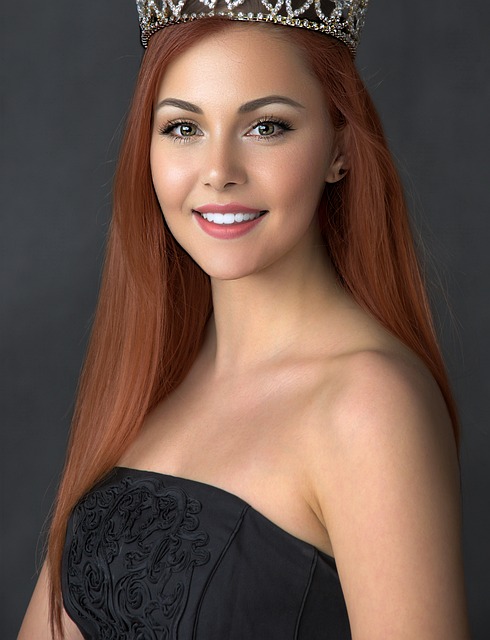 也需要联盟 也需要联盟